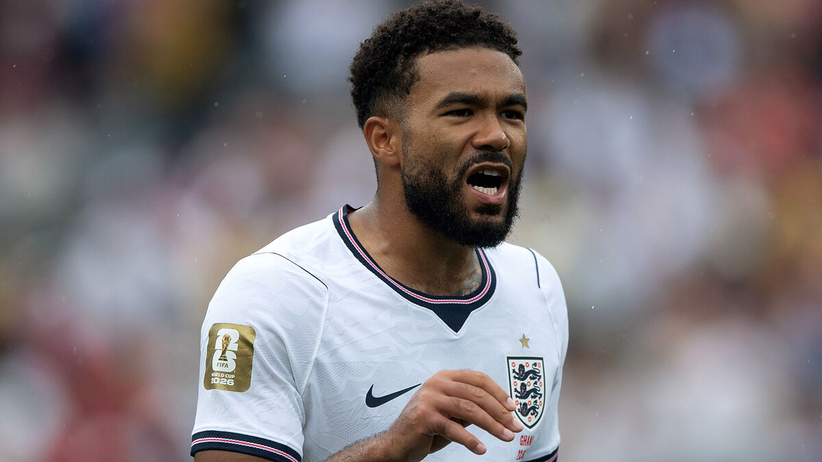 England trying to fast track James' recovery ahead of Norway